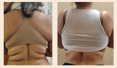 Carla Colin, DNP,FNP-BC, medical provider specialize in Weight Loss, PRP, Dermatology, hair restoration, Anti-aging, Skin Rejuvenation, Botox, Holistic Medicine, ozempic, wegovy, mounjaro, semaglutide, zepbound, tirzepatide, LipoB, MICC, B12, Alopecia, Women hair loss, Men hair loss