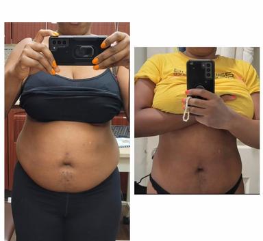 Carla Colin, DNP,FNP-BC, medical provider specialize in Weight Loss, PRP, Dermatology, hair restoration, Anti-aging, Skin Rejuvenation, Botox, Holistic Medicine, ozempic, wegovy, mounjaro, semaglutide, zepbound, tirzepatide, LipoB, MICC, B12, Alopecia, Women hair loss, Men hair loss