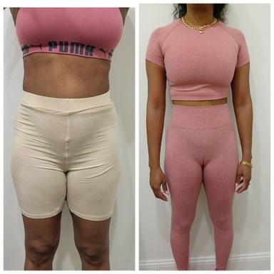 Sergina Jean, FNP-BC, medical provider specialize in Weight Loss, Medication management for Zepbound, Wegovy, Mounjaro, compounding semaglutide, Family Medicine, Cardiology