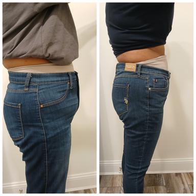 Sergina Jean, FNP-BC, medical provider specialize in Weight Loss, Medication management for Zepbound, Wegovy, Mounjaro, compounding semaglutide, Family Medicine, Cardiology