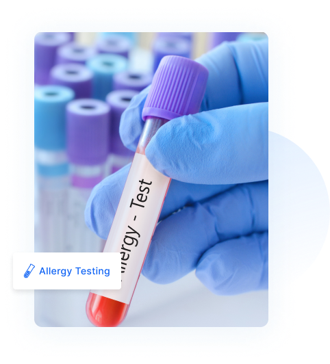 allergy test